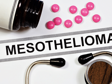 Canton Mesothelioma Legal Question