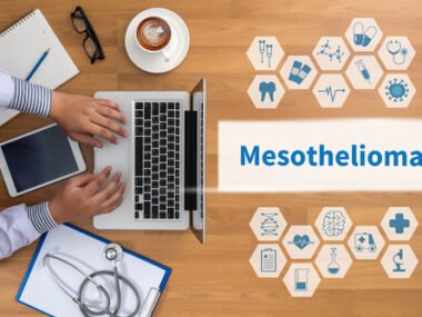 Monroe Mesothelioma Legal Question