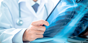 Grand Rapids Mesothelioma Legal Questions