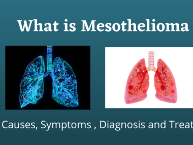 Warren Mesothelioma Legal Question