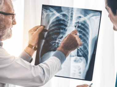 Buffalo Mesothelioma Legal Question