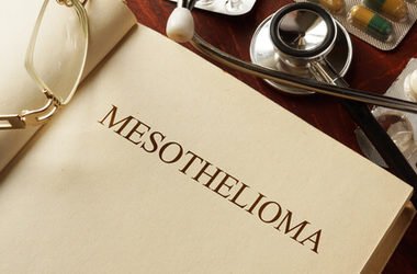 Westminster Mesothelioma Legal Question