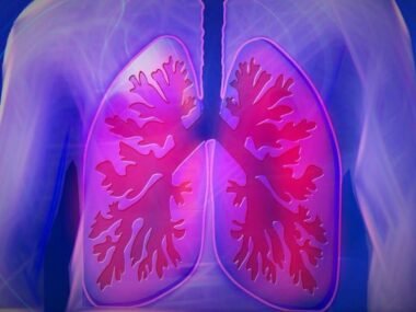 Warren Mesothelioma Legal Question