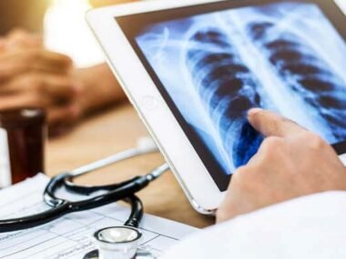 Rochester Mesothelioma Legal Question